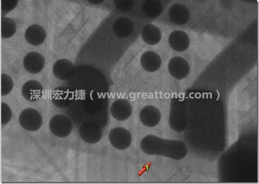 BGA因?yàn)楹笁|變小，造成錫膏過多而最終形成焊接短路的結(jié)果。